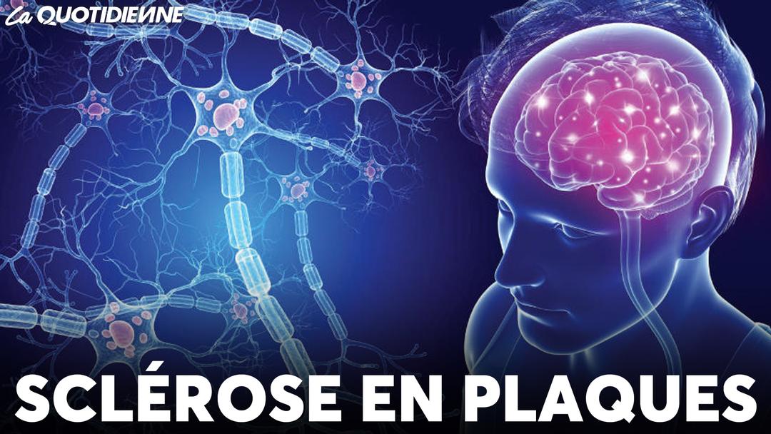 Épisode 715 : Sclérose en plaques