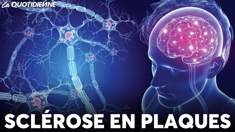 Épisode 715 : Sclérose en plaques