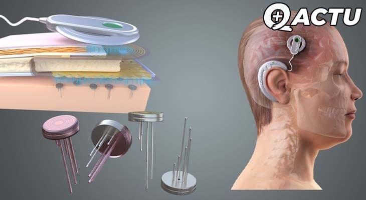 Le premier tweet posté via une puce cérébrale