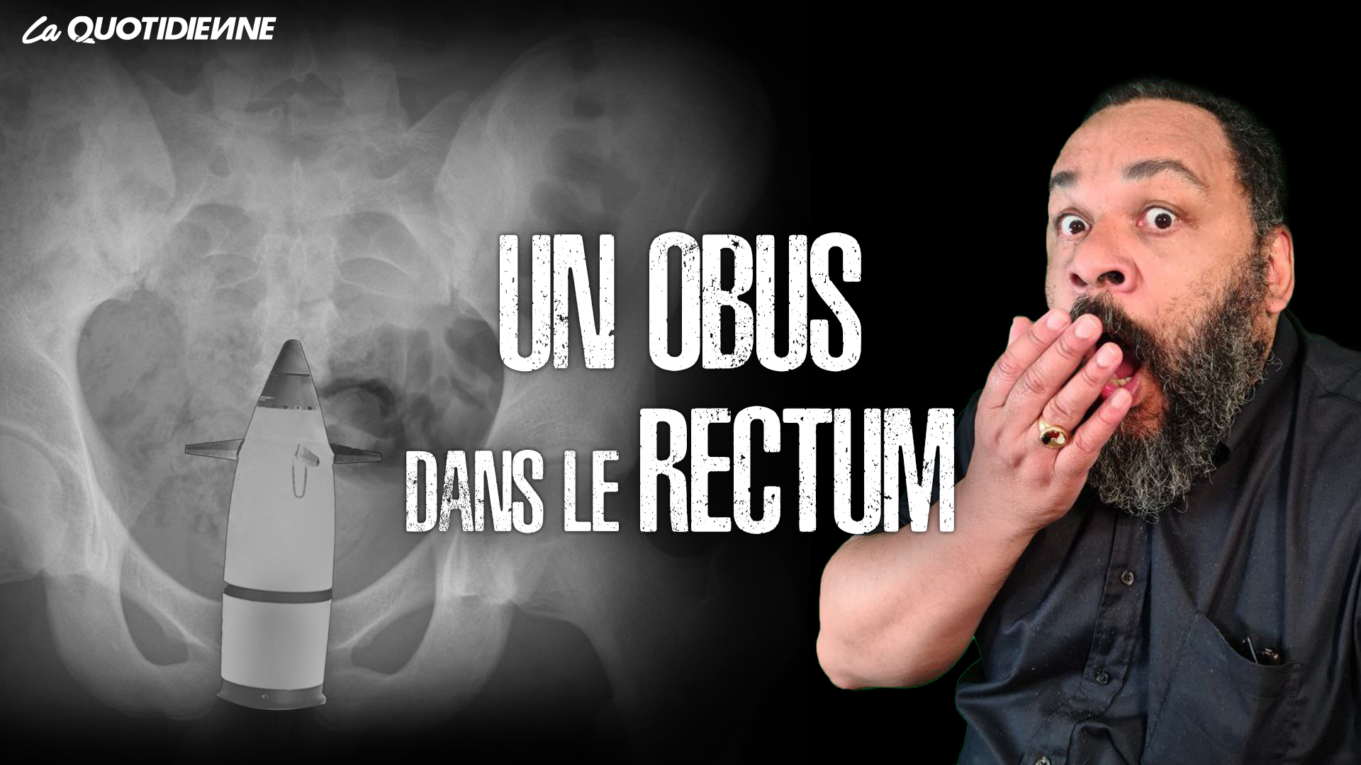 Épisode 370 : Un obus dans le rectum - myQUENEL