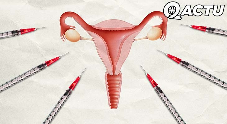 Vaccin : des effets secondaires sur le cycle menstruel ?
